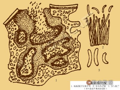 梨树腐烂病