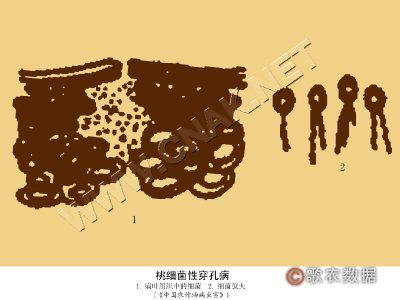 桃细菌性穿孔病