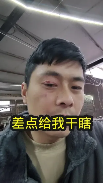 以我为戒，大家以后干活的时候一定加倍小心#养羊 #养羊人 #养羊人不容易