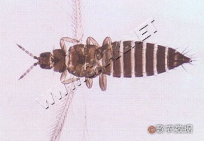 Ἳ